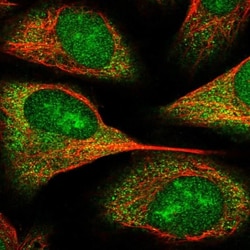 TRIM40 Antibody, Novus Biologicals:Antibodies:Primary Antibodies