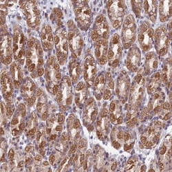 TRIM40 Antibody, Novus Biologicals:Antibodies:Primary Antibodies