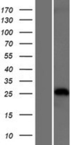 Novus Biologicals&trade;&nbsp;TRIM40 Overexpression Lysate