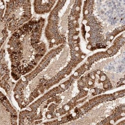 TRIM41 Antibody, Novus Biologicals 0.1mL; Unlabeled:Antibodies, Polyclonal