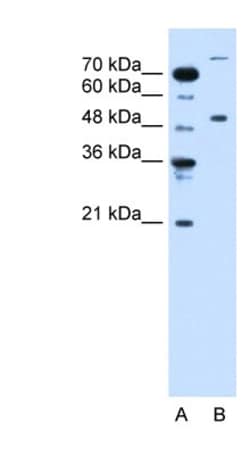 TRIM42 Antibody, Novus Biologicals:Antibodies:Primary Antibodies