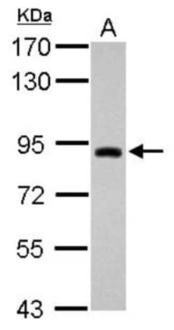 TRIM42 Antibody, Novus Biologicals 0.1mL; Unlabeled:Antibodies, Polyclonal
