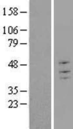 Novus Biologicals&trade;&nbsp;TRIM43 Overexpression Lysate