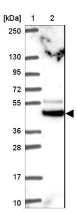 TRIM44 Antibody, Novus Biologicals:Antibodies:Primary Antibodies