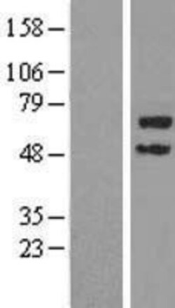 Novus Biologicals™ TRIM45 Overexpression Lysate