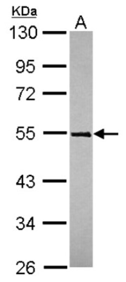 TRIM49 Antibody, Novus Biologicals 0.1mL; Unlabeled:Antibodies, Polyclonal