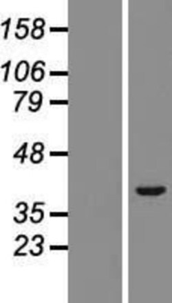 Novus Biologicals&trade;&nbsp;TRIM52 Overexpression Lysate