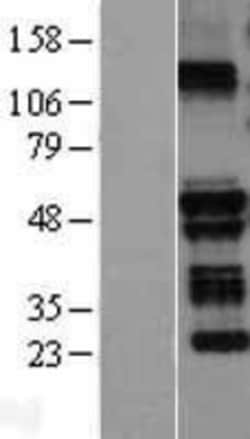 Novus Biologicals&trade;&nbsp;TRIM58 Overexpression Lysate
