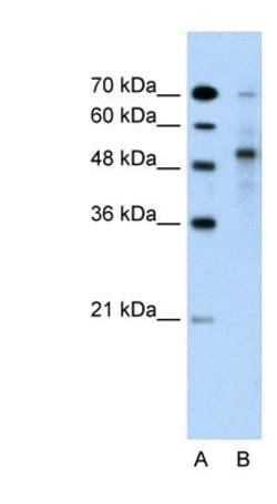 TRIM59 Antibody, Novus Biologicals 100 ul; Unconjugated:Antibodies, Polyclonal