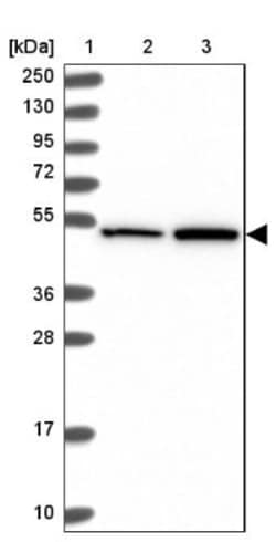 TRIM64A Antibody, Novus Biologicals 25 &mu;L, Unlabeled:Antibodies, Polyclonal