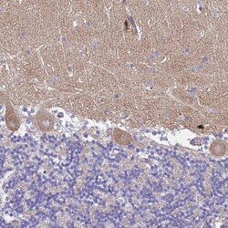 TRIM64A Antibody, Novus Biologicals 25 &mu;L, Unlabeled:Antibodies, Polyclonal