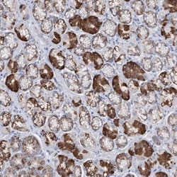 LIN-41/TRIM71 Antibody, Novus Biologicals 0.1mL; Unlabeled:Antibodies,