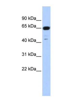 TRIM72 Antibody, Novus Biologicals 0.05mg; Unlabeled:Antibodies, Polyclonal
