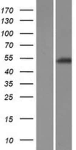 Novus Biologicals&trade;&nbsp;TRIM72 Overexpression Lysate