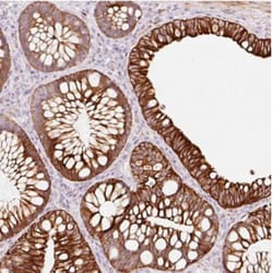 TRIM73 Antibody, Novus Biologicals 0.1mL; Unlabeled:Antibodies, Polyclonal