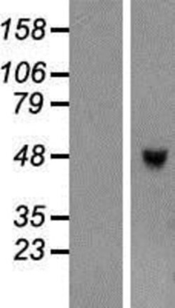 Novus Biologicals™ TRIML1 Overexpression Lysate