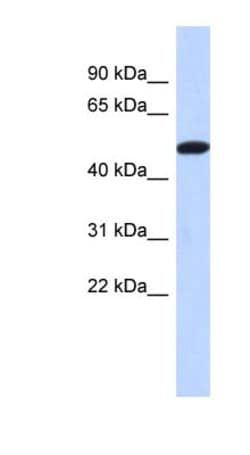 TRIML2 Antibody, Novus Biologicals 100 &mu;L | Buy Online | Novus Biologicals | Fisher Scientific
