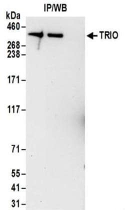 TRIO Antibody, Novus Biologicals 100 &mu;L | Buy Online | Novus Biologicals | Fisher Scientific