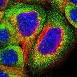 TRIOBP Antibody, Novus Biologicals 0.1mL; Unlabeled:Antibodies, Polyclonal