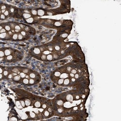 TRIOBP Antibody, Novus Biologicals 0.1mL; Unlabeled:Antibodies, Polyclonal