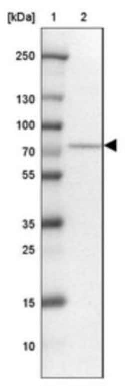 TRIOBP Antibody, Novus Biologicals 25 &mu;L; Unlabeled:Antibodies, Polyclonal