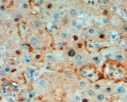 Triosephosphate isomerase Antibody, Novus Biologicals 0.1mg; Unlabeled:Antibodies,