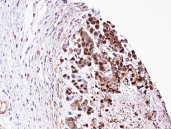 Triosephosphate isomerase Antibody, Novus Biologicals 0.1mg; Unlabeled:Antibodies,