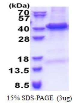 Novus Biologicals&trade;&nbsp;Recombinant Human TRIP1 His Protein