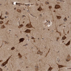 TRIP1 Antibody, Novus Biologicals 0.1mL; Unlabeled:Antibodies, Polyclonal