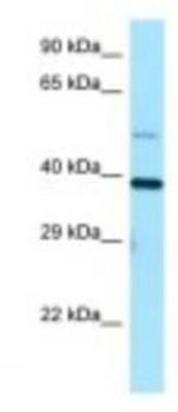 TRIP1 Antibody, Novus Biologicals 100 &mu;L | Buy Online | Novus Biologicals | Fisher Scientific