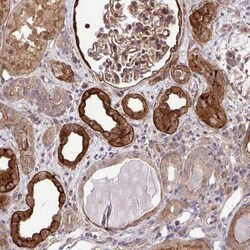 TRIP6 Antibody, Novus Biologicals:Antibodies:Primary Antibodies