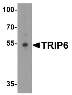 TRIP6 Antibody - BSA Free, Novus Biologicals 0.025 mg, Unconjugated:Antibodies,