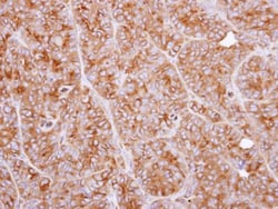 Tripeptidyl-Peptidase I/TPP1 Antibody, Novus Biologicals 0.1mL; Unlabeled:Antibodies,