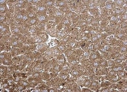 Tripeptidyl-Peptidase I/TPP1 Antibody, Novus Biologicals 0.1mL; Unlabeled:Antibodies,