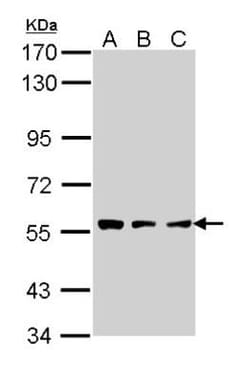 Tripeptidyl-Peptidase I/TPP1 Antibody, Novus Biologicals 0.1mL; Unlabeled:Antibodies,
