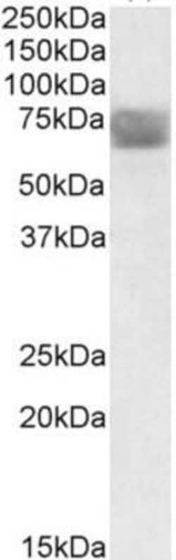 Tripeptidyl-Peptidase I/TPP1 Antibody, Novus Biologicals 0.1mg; Unlabeled:Antibodies,