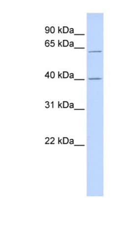 TRIT1 Antibody, Novus Biologicals 100&mu;L; Unlabeled:Antibodies, Polyclonal