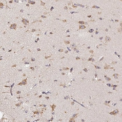 TrkA Antibody, Novus Biologicals:Antibodies:Primary Antibodies