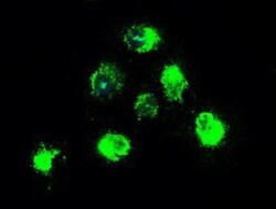 TrkB Antibody (OTI2E1), Novus Biologicals 0.1mL; Unlabeled:Antibodies,
