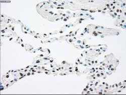 TrkB Antibody (OTI2E1), Novus Biologicals 0.1mL; Unlabeled:Antibodies,