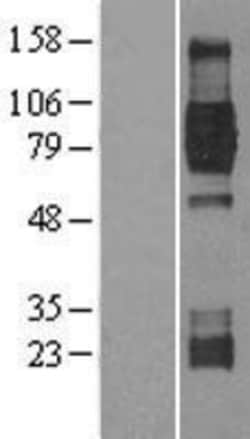 Novus Biologicals&trade;&nbsp;TrkB Overexpression Lysate