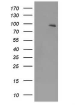 TrkB Antibody (OTI2E1), Novus Biologicals 0.1mL; Unlabeled:Antibodies,