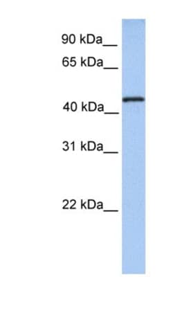 TRM11 Antibody, Novus Biologicals 100&mu;L; Unlabeled:Antibodies, Polyclonal