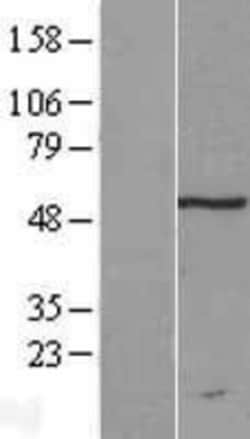 Novus Biologicals&trade;&nbsp;TRM11 Overexpression Lysate