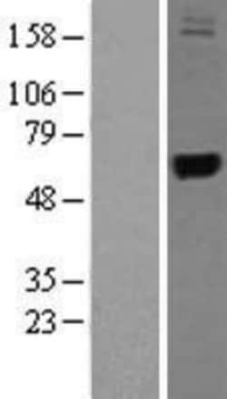Novus Biologicals&trade;&nbsp;TRMU Overexpression Lysate