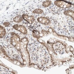TRMT12 Antibody, Novus Biologicals 25 &mu;L; Unlabeled:Antibodies, Polyclonal