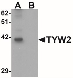 TRMT12 Antibody - BSA Free, Novus Biologicals 0.1mg; Unlabeled:Antibodies,