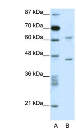 TRMT1L Antibody, Novus Biologicals 100&mu;L; Unlabeled:Antibodies, Polyclonal