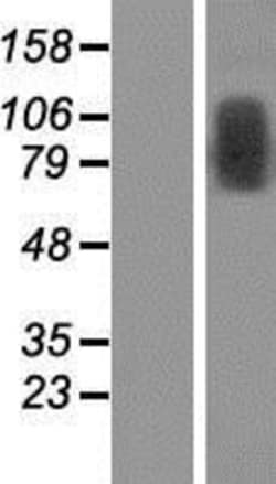 Novus Biologicals&trade;&nbsp;TRMT1L Overexpression Lysate