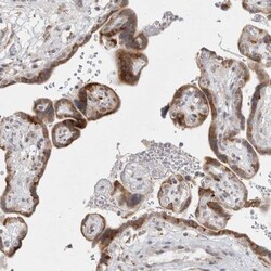 TRMT1L Antibody, Novus Biologicals:Antibodies:Primary Antibodies